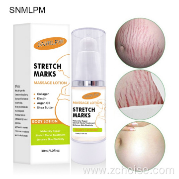 best pregnancy remover removal stretch mark cream